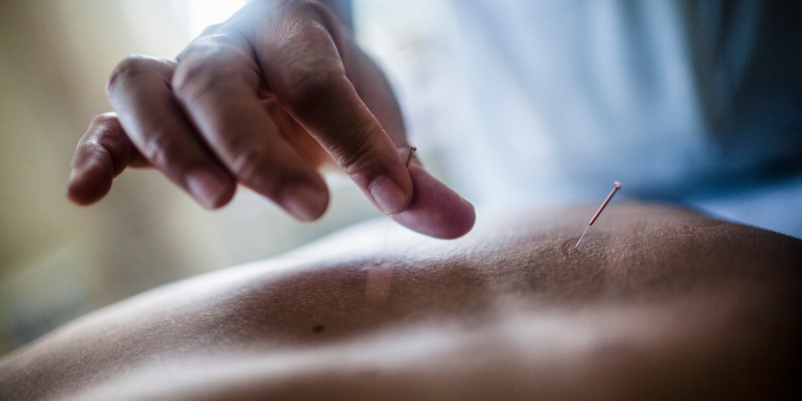 Close up of hand holding fine needle, performing acupuncture on a patient's back