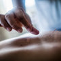 Close up of hand holding fine needle, performing acupuncture on a patient's back